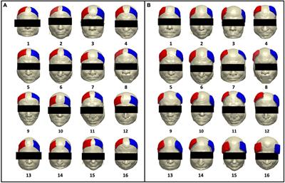 Impact of electrode selection on modeling tDCS in the aging brain